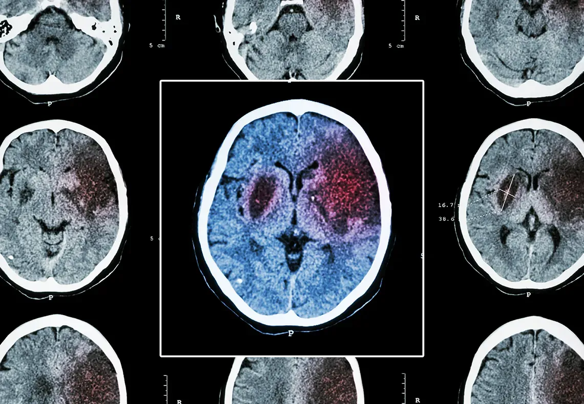 Brain scan image